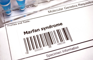 Marfan syndrome specimen information